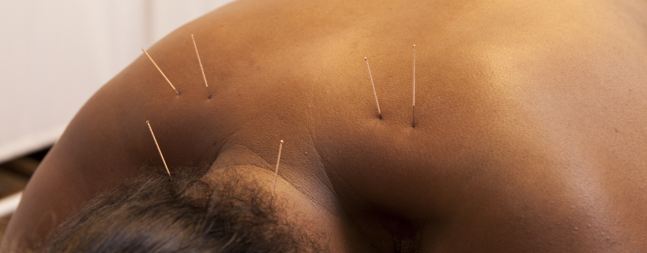 physical-therapy-clinic-dry-needling-atrium-physical-therapy-las-cruces-nm