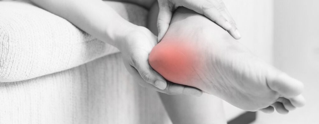 Heel Spurs: Diagnosis, Treatment, and Preventive Measures