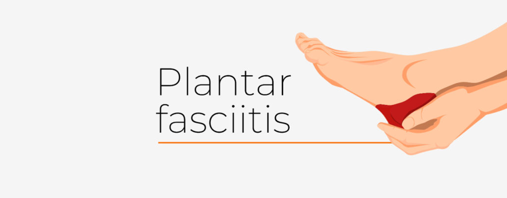 Plantar Fasciitis Relief: Effective Treatments for Foot Pain